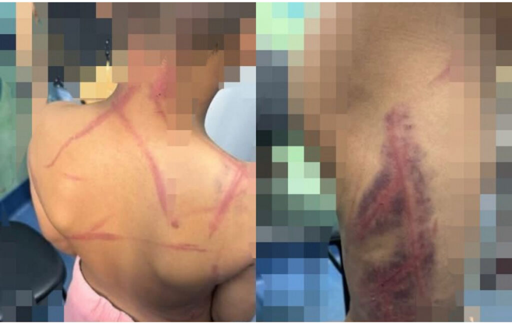 Pais são presos por espancar criança de 9 anos